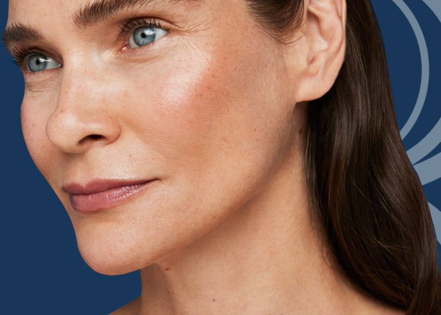 Radiesse Collagen Banking